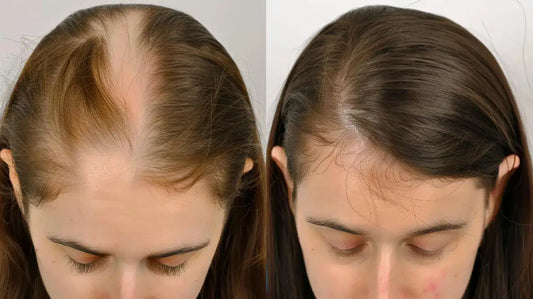 Zarqa Organic Hair Growth Oil
